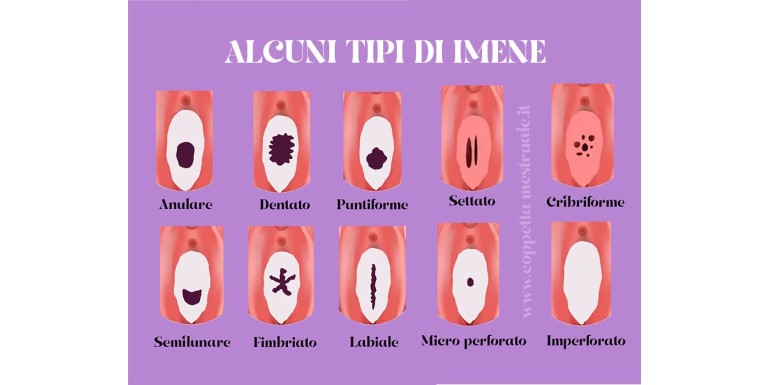 L’imene si rompe davvero? La verità scientifica sulla verginità